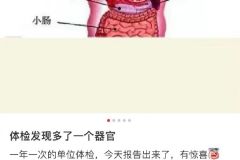 体检报告出来了发现多了一个器官 ​​​